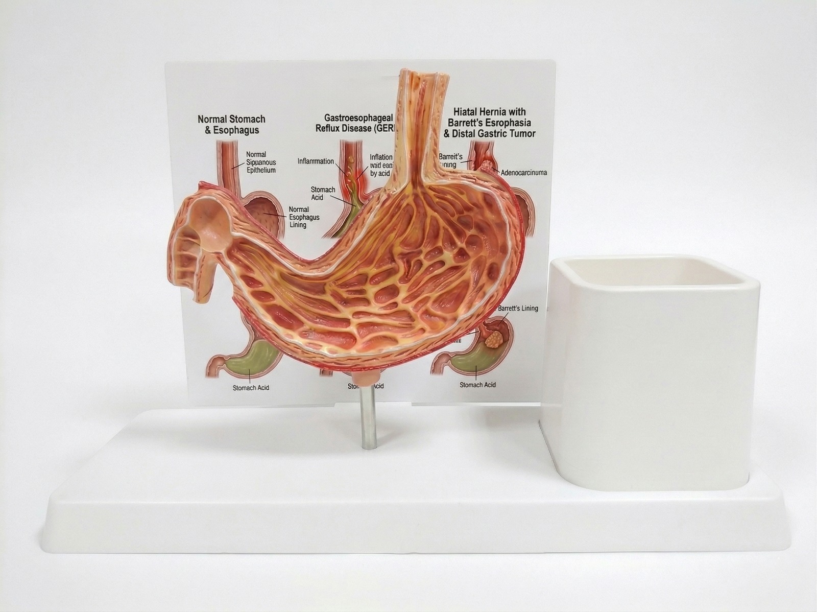 Stomach model with pen stand
